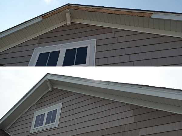 Fascia repair before and after